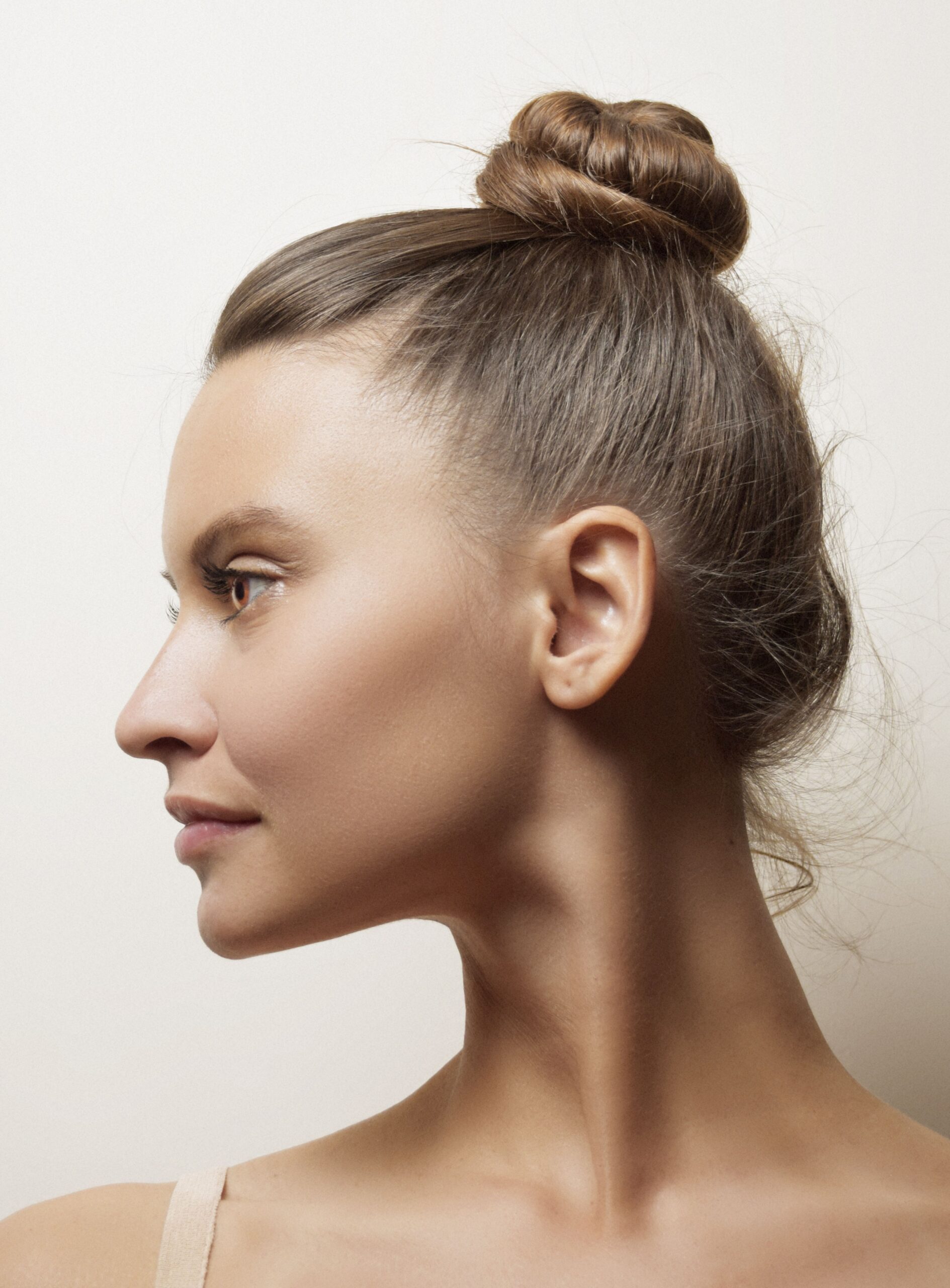 Otoplasty (Ear Surgery)