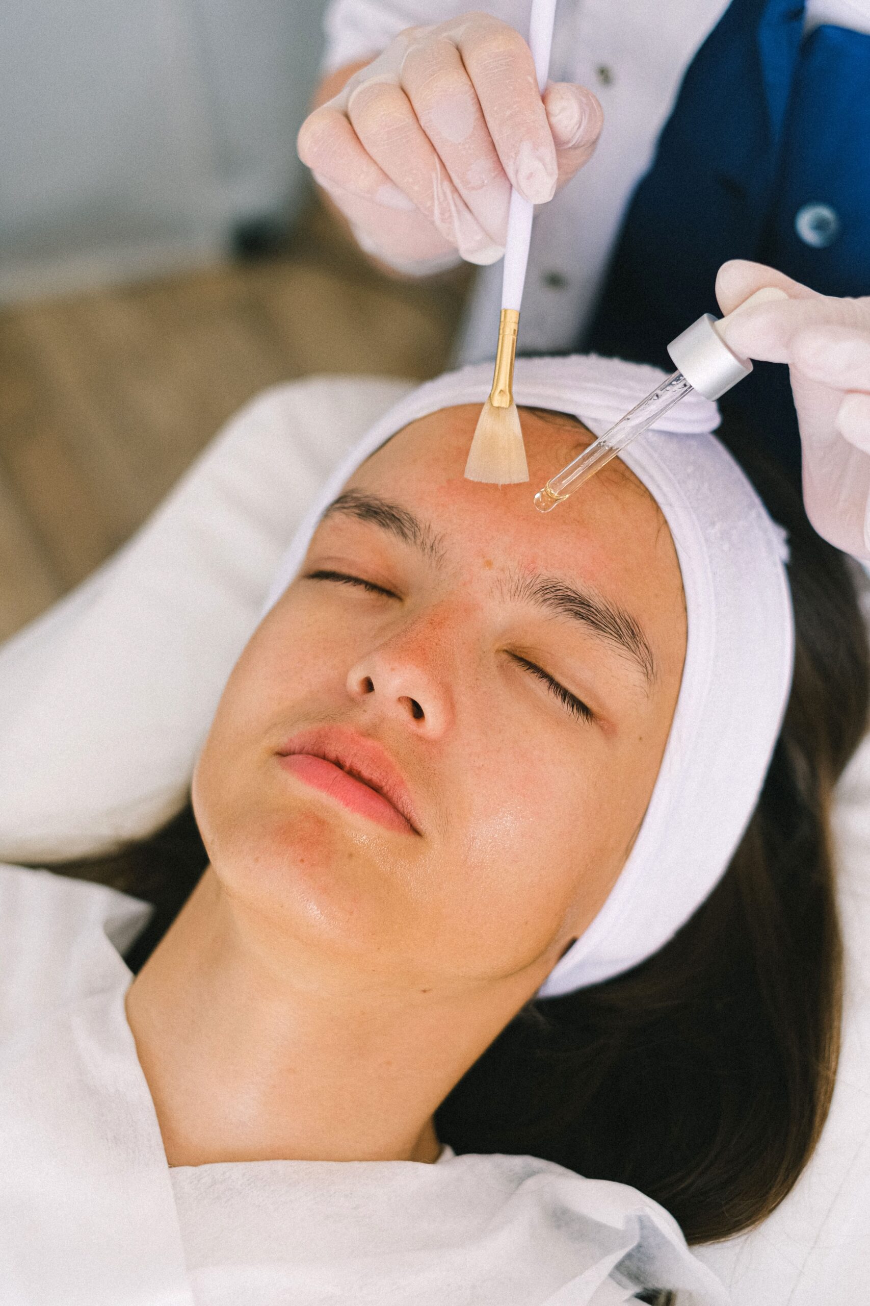 Chemical Peels & Laser Treatments